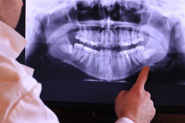 Best Emergency Treatment for Jaw Pain or Injury in Azle, TX