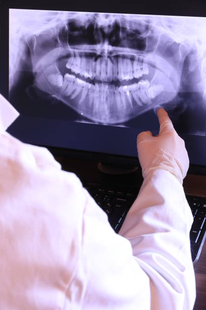 Best Emergency Wisdom Tooth Extraction in Azle, TX